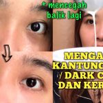 Atasi Kantung Mata Hitam Dengan Perawatan Harian Yang Tepat