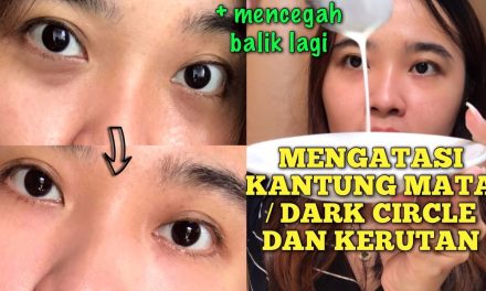 Atasi Kantung Mata Hitam Dengan Perawatan Harian Yang Tepat