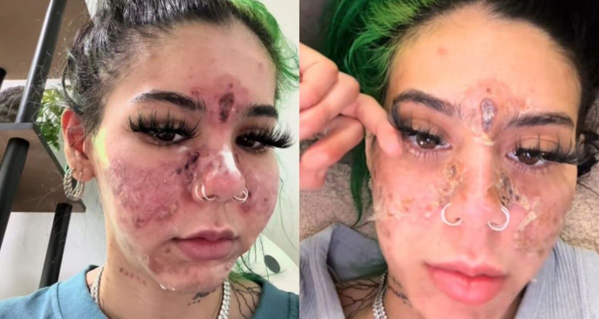 Efek Ketika Menggunakan Make-Up Yang Sudah Kadaluwarsa