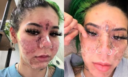 Efek Ketika Menggunakan Make-Up Yang Sudah Kadaluwarsa